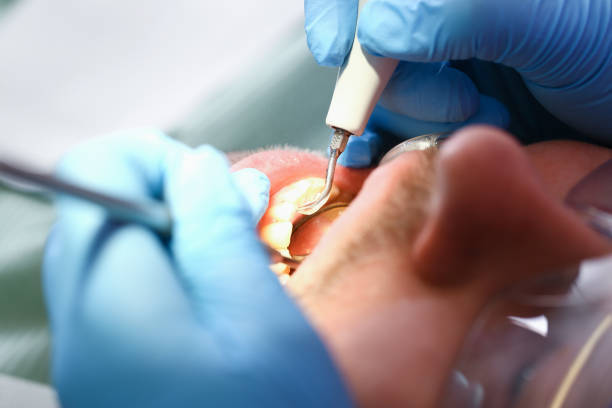 Best Pediatric Emergency Dentist in Sandy, OR